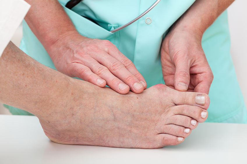 Best shoe insoles for bunions sale