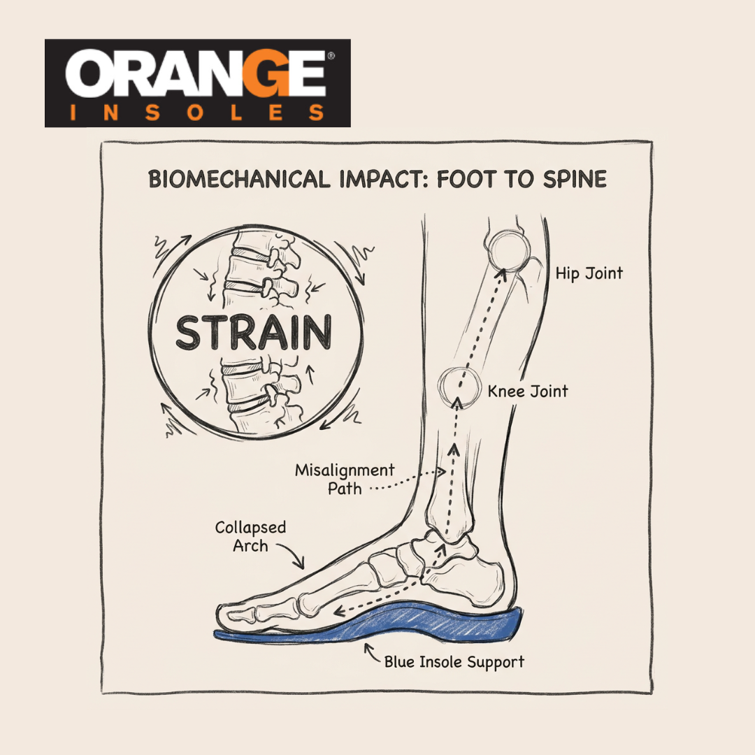 Can Insoles Help with Lower Back Pain? What the Research Says