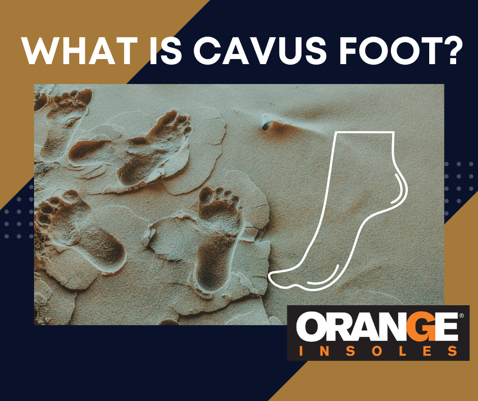 What is Cavus Foot?