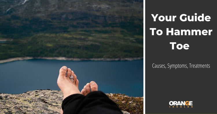 Your Guide To Hammer Toe – Orange Insoles